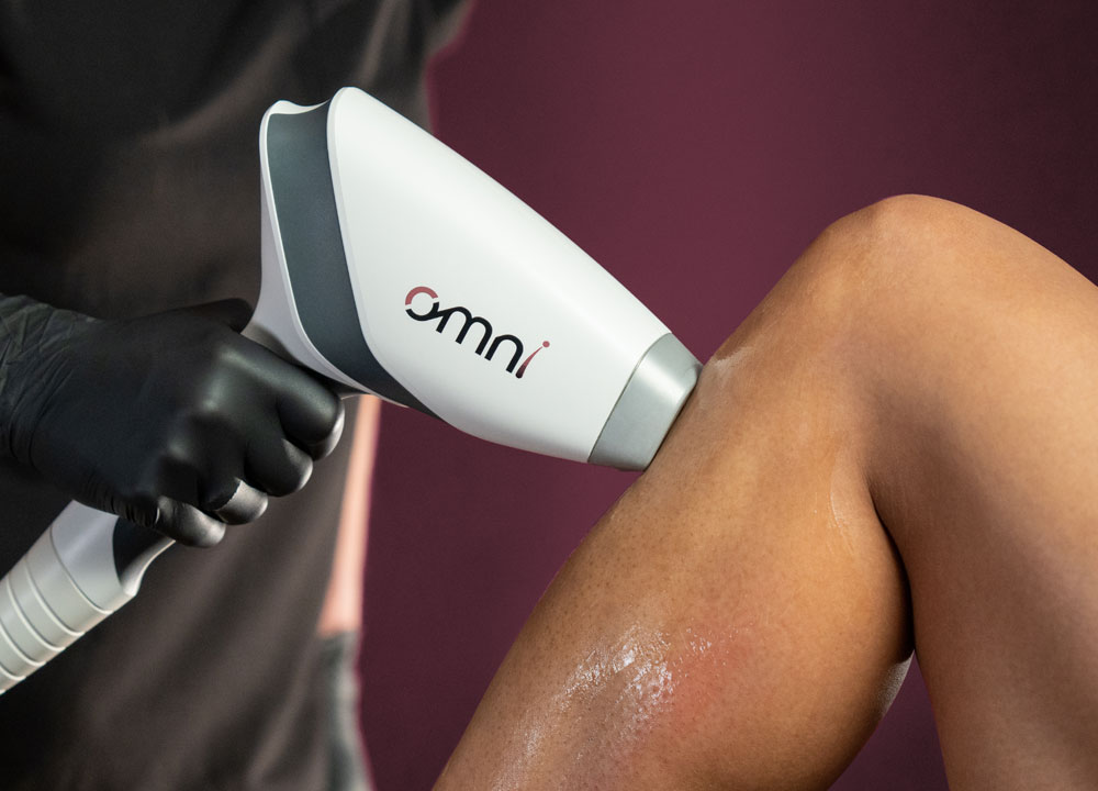 Sciton OMNI hair removal system handpiece removing hair from a woman's leg