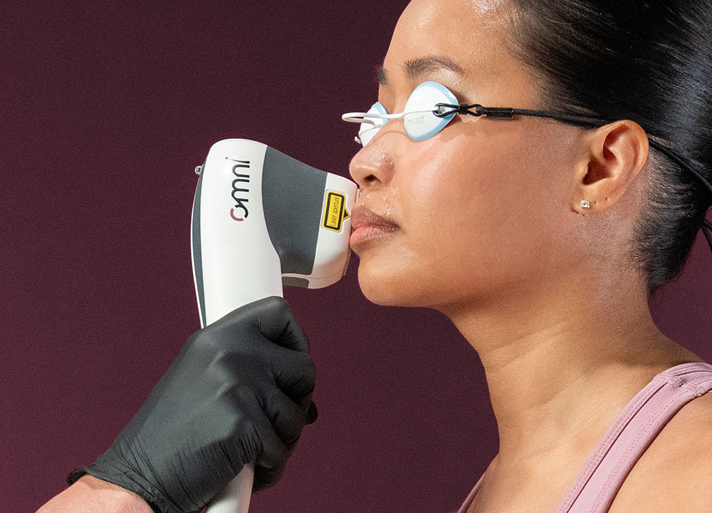 Sciton OMNI hair removal system handpiece removing hair from a woman's face