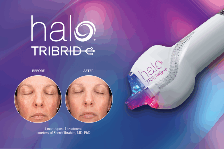 HALO TRIBRID cover image.
