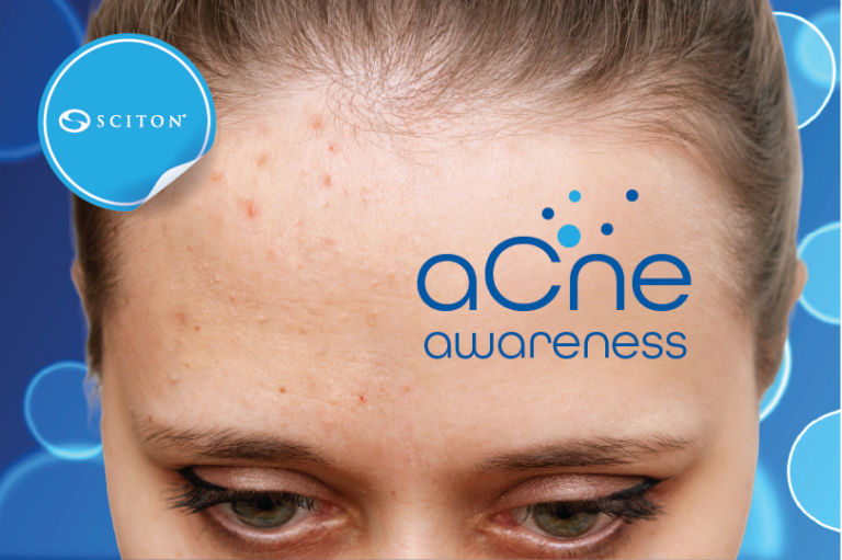 Acne Awareness